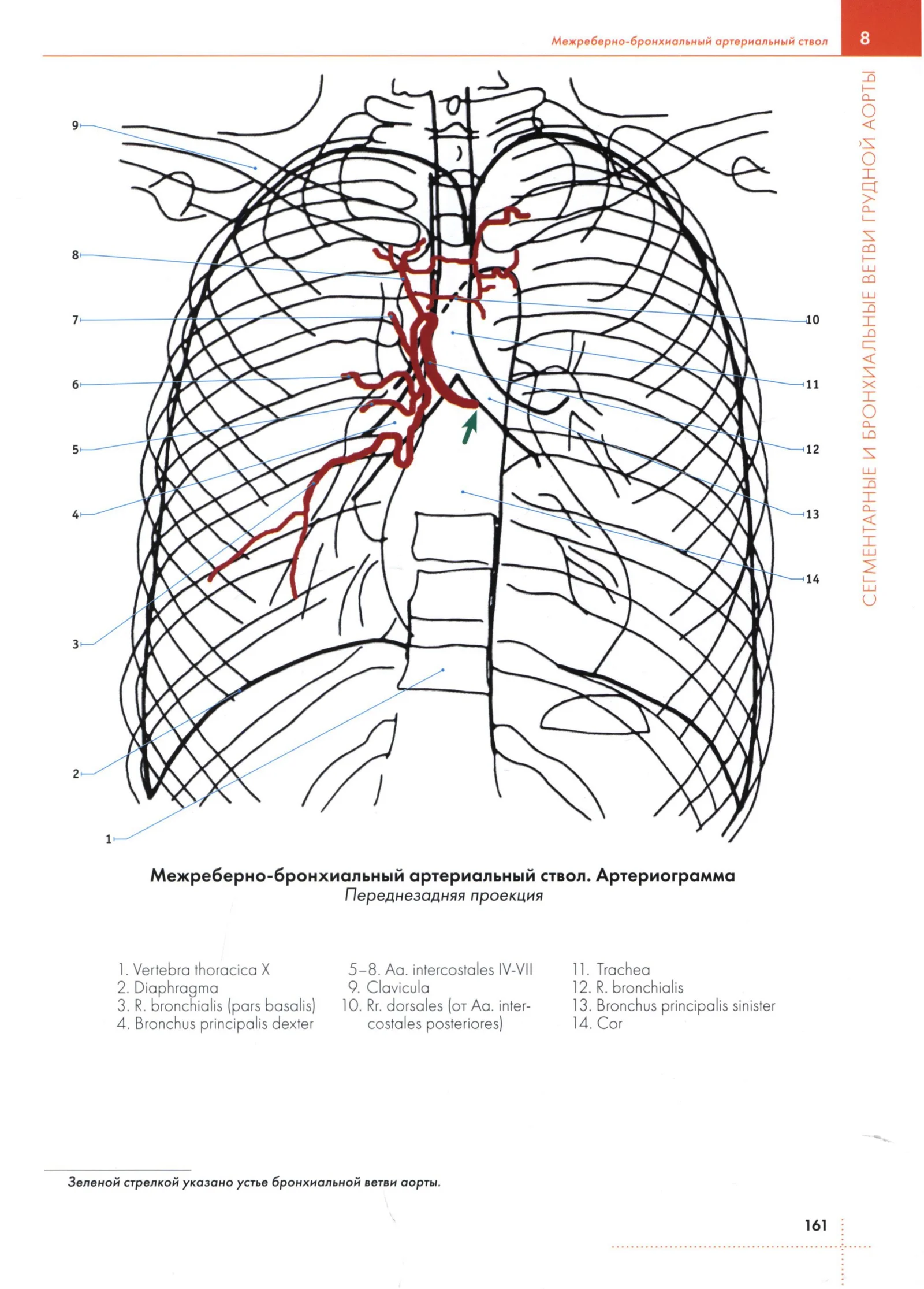 Межреберно-бронхиальный артериальный ствол. Артериограмма